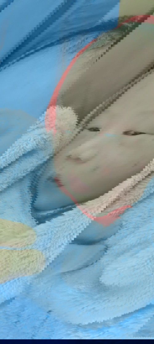 เจ็บแผลผ่าคลอด