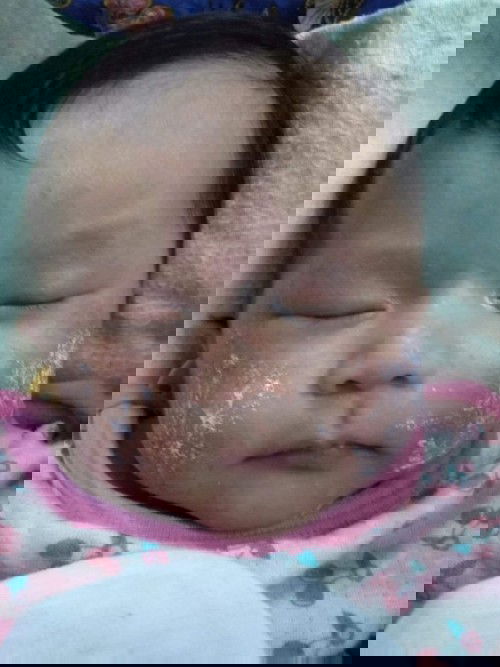 กลากน้ำนม💧