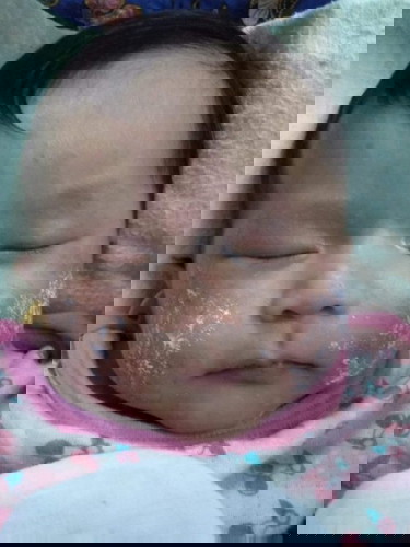 กลากน้ำนม💧