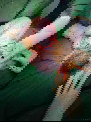 Trusting the Process: Baby Out at 37w1d