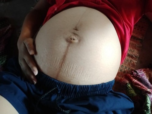 สอบถามเเม่ๆเเต่ละบ้านหน่อยจ้า