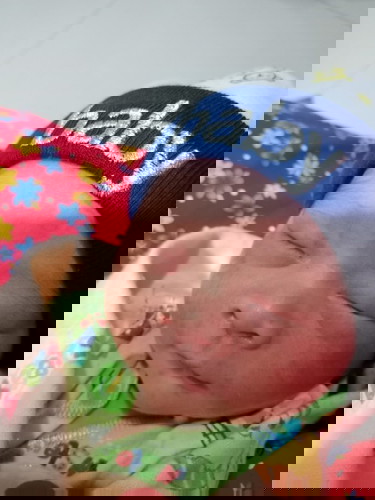 Gara-gara ASI bayi jadi kuning?