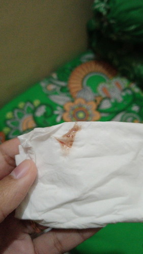 Bun, jika keluar keputihan tapi seperti itu bahaya apa tidak? Saya hamil 9w 5d
Mohon di jawab🙏