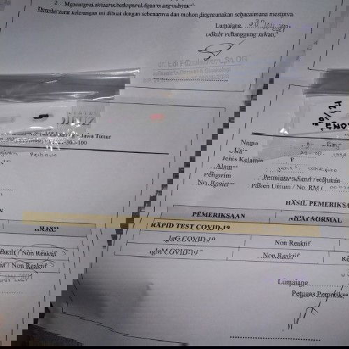 Pengalaman kontrol hari ini