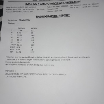 Need second opinion for this?