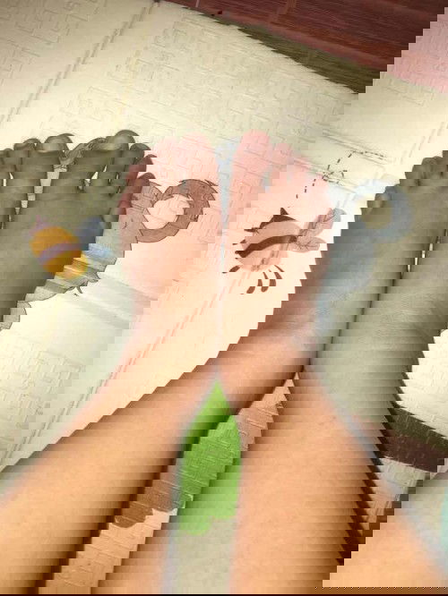 37 week ปวดหน่วงด้านขวา มือเท้าบวม เดินยาก