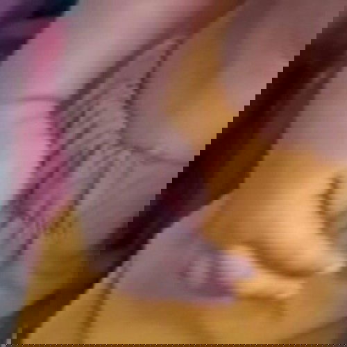 Jempol tangan kanan dan kiri yang selalu menekuk