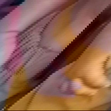 Jempol tangan kanan dan kiri yang selalu menekuk