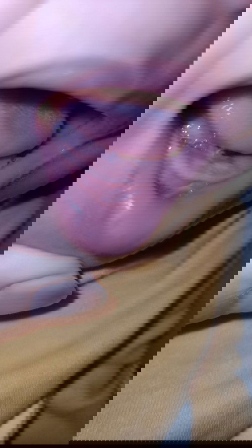 Bunda-bunda, di gusi anak saya seperti ada putih2 samar, apakah benar itu tanda mau tumbuh gigi ya?