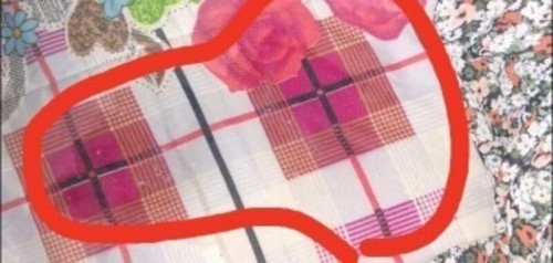 ตกขาวหรือมูกใสหรือน้ำคล่ำ