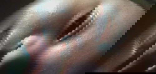 Bola mata ada bintik putih