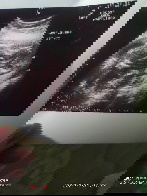 Bikin worry😢😢😥