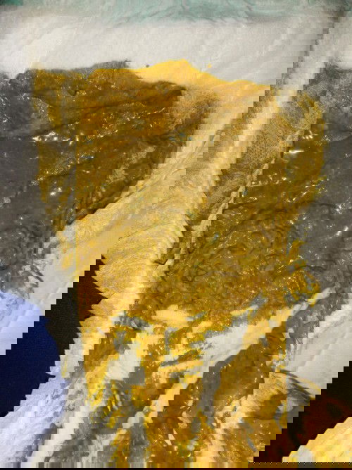 ลูกไม่ถ่าย