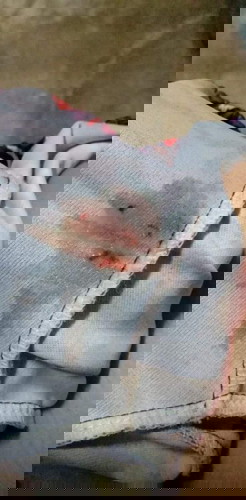 ตั้งครรภ์10w