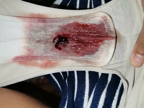 Dugo after akong i,e?