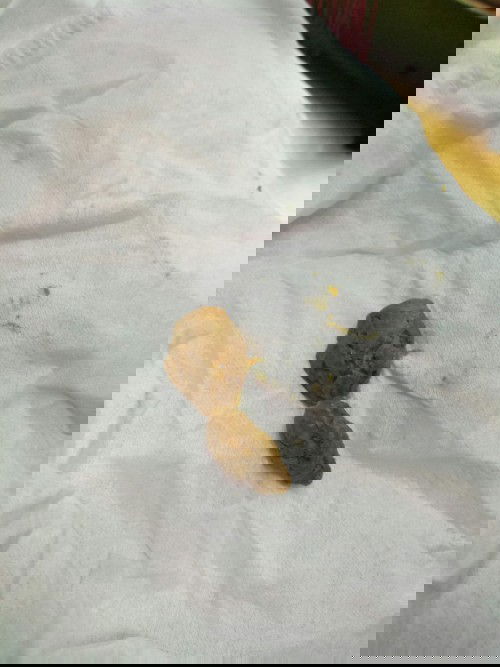 Belum pup 3hari baby 6 bulan