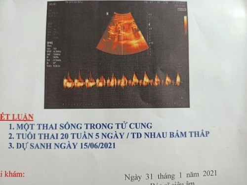 Chim non mọc muộn