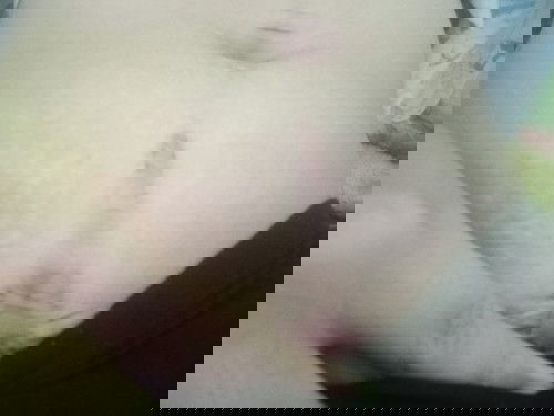 แผลผ่าคลอด