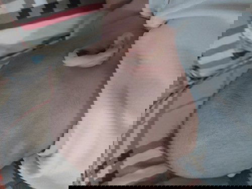 Pitak pada kepala bayi