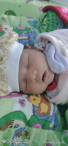 Alhamdulilah telah lahir anak pertama kamii M.Rafisqi Azka S
BB 3,8
PB 50
Bonus obras luar dalam😁