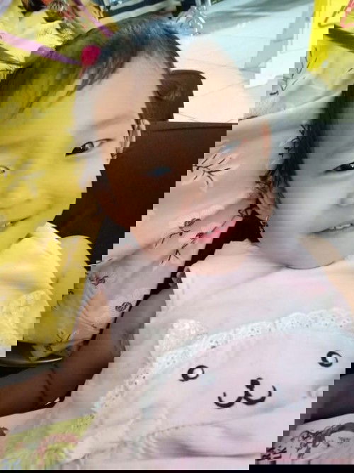 Lahiran normal pasca operasi Caesar