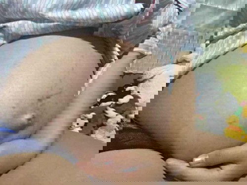 31weekแล้ว อยากแตกมาก 😂😂