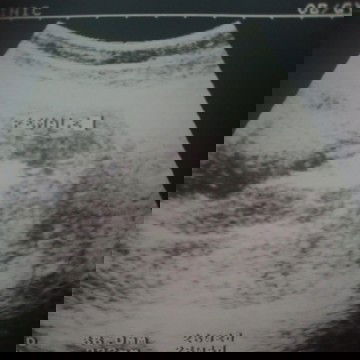 น้อง ผช หรือ ผญ คะแม่ๆช่วยดูหน่อยคะ🥰