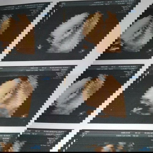 Cùng chia sẻ kinh nghiệm thời gian mang thai