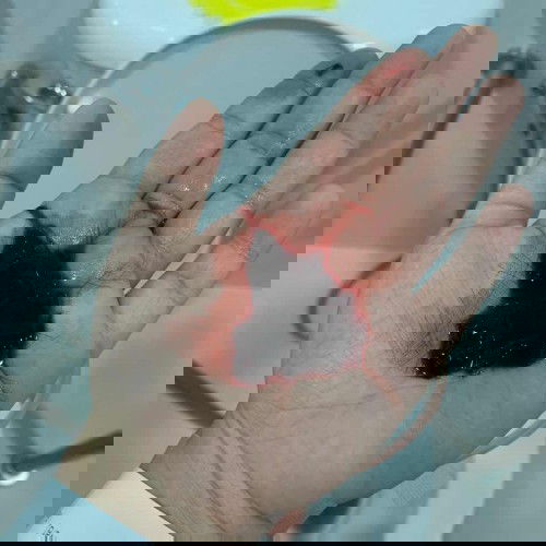 มีภาวะแท้งคุกคามค่ะ