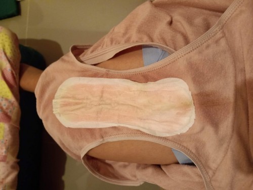 Good day po mga mommies, normal lang po ba Ito for 34 weeks pregnant?. Pag-gising ko this morning