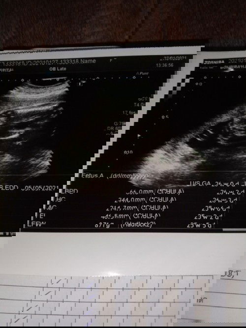 26+1อยากรู้เพศให้แน่ใจ ใครรู้ไมจ้ะ