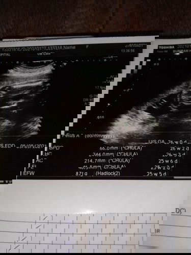 26+1อยากรู้เพศให้แน่ใจ ใครรู้ไมจ้ะ