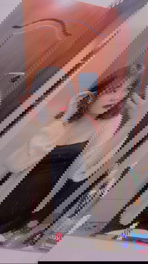 Rạn bụng thai kì