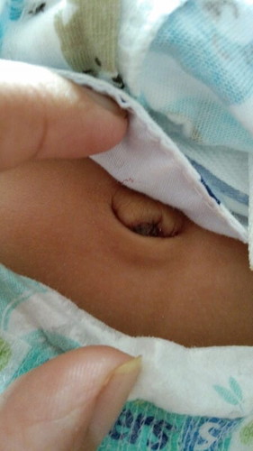 Masalah pusat baby