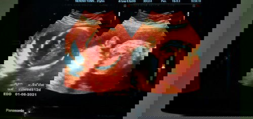 Jk nya gak kelihatan .