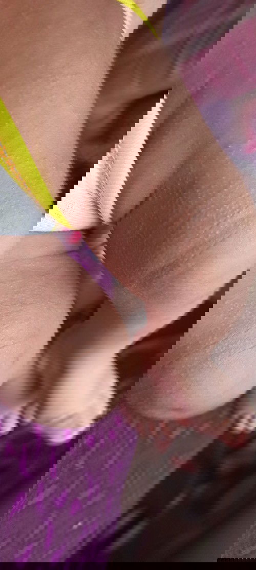 Beruntusan baby 2bulan