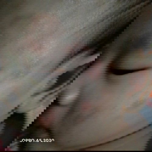 Sức khỏe của bé