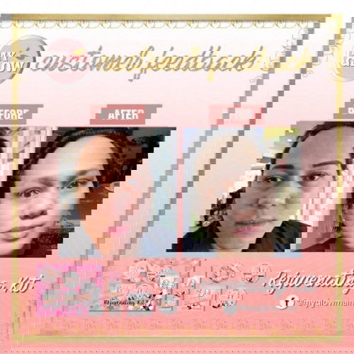 My Glow! Rejuvenating kit ❤❤❤