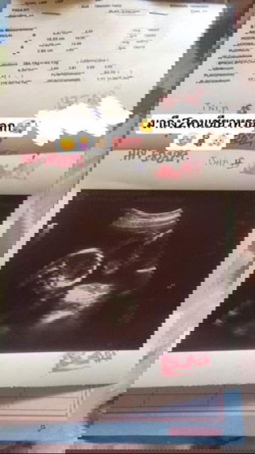 รอเจอหน้าไอ้ต้าวแฝดทั้งสอง🥰❤️👨‍👩‍👧‍👦