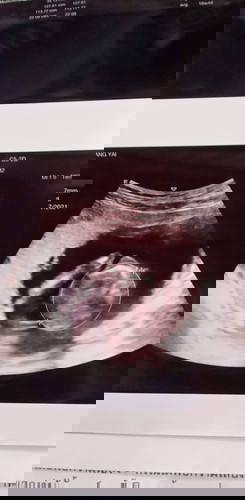 เพสอะไรคะพอเดาได้ไหม555