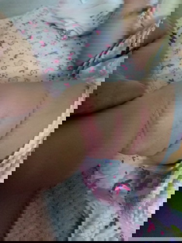 Rashes, or ano po?