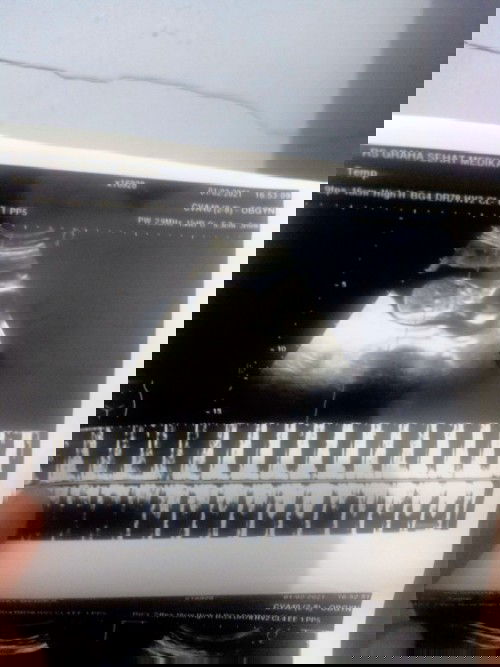 19weeks JK blm terlihat