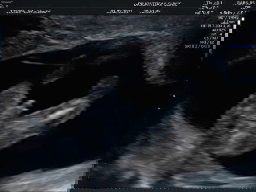 รู้เพศกันแล้วจ้า 🥰