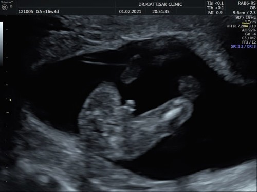 รู้เพศกันแล้วจ้า 🥰