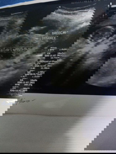 ขอบคุณคำตอบค่ะ