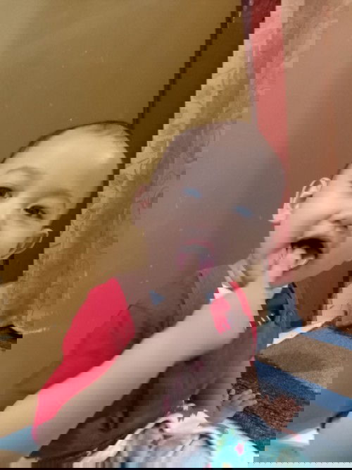 16 bulan rambutnya masih tipis.