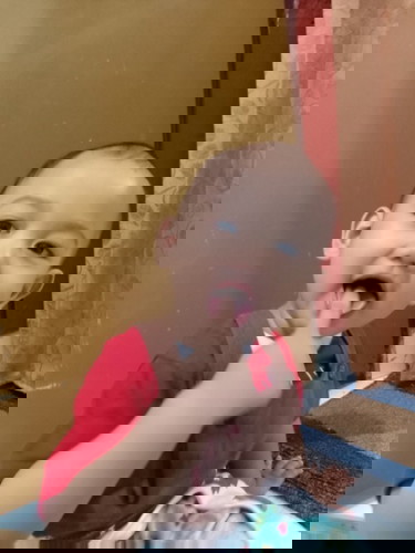 16 bulan rambutnya masih tipis.