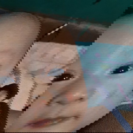 Abot baby rashes
