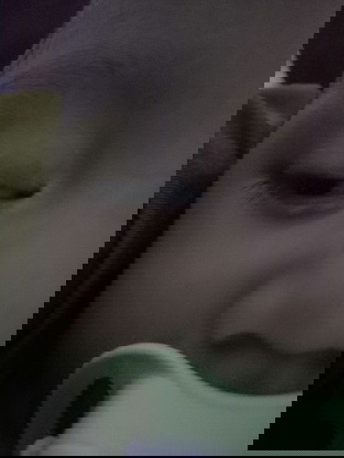 Mata bawah bayi bentol putih..