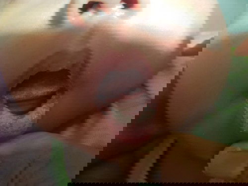 Lidah dan bibir putih putih